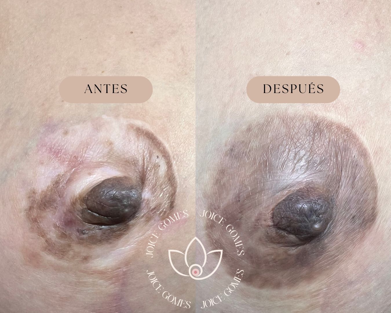 801db6846e8ac60973d2879ecbb8b7d37c0c1c56